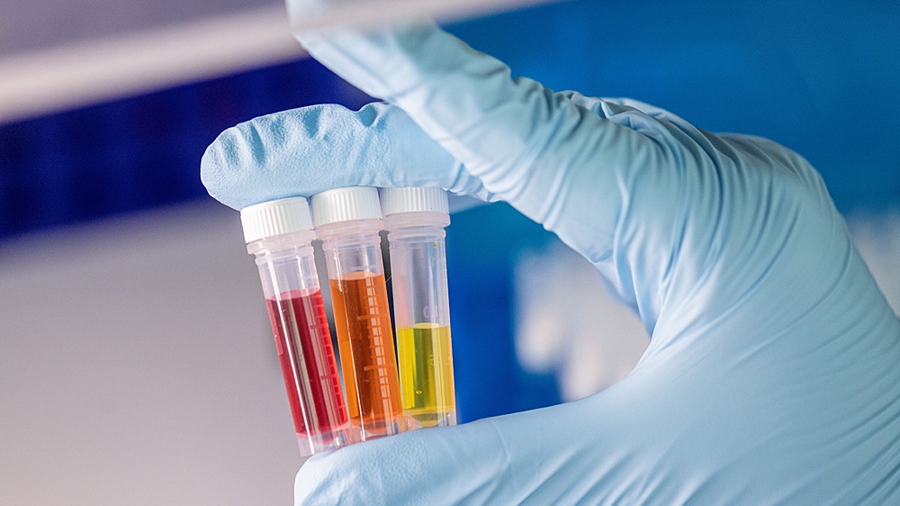 Blue gloved hand holds three vials of red, orange, and yellow liquid. 